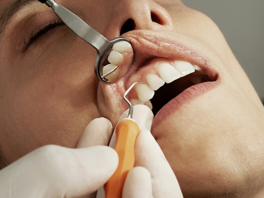 Imagen de referencia de odontología general