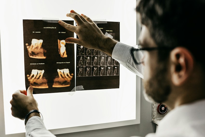 Imagen de referencia de implantes dentales